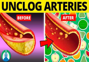 Foods That Unclog Arteries (Most People Ignore)